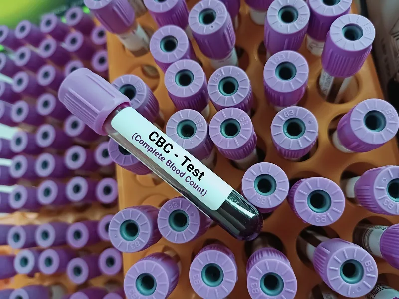 Types of Blood Tests