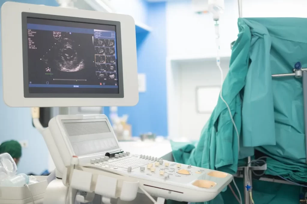 Transesophageal Echocardiogram (TEE)