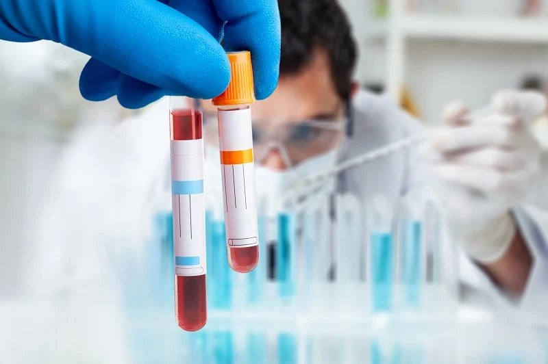What Is a Blood Test?