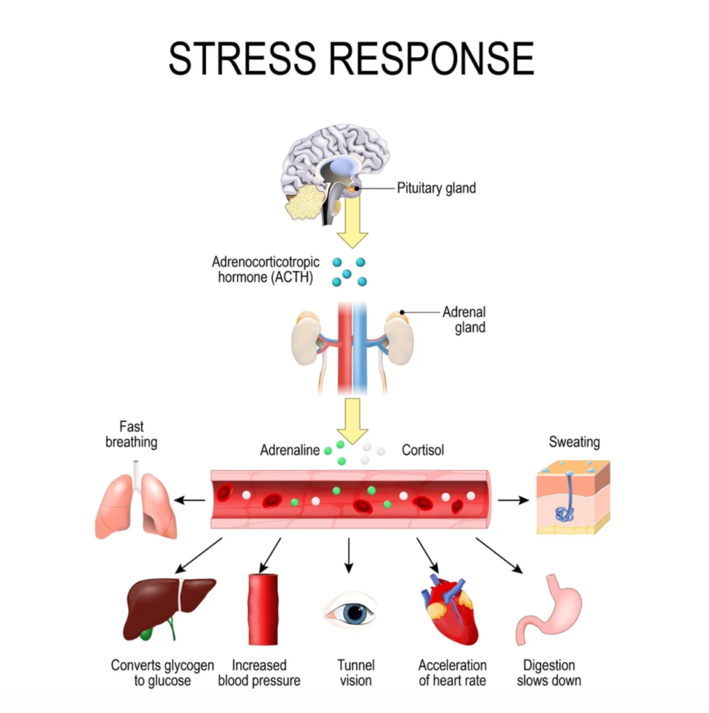 Stress An Underappreciated Risk Factor For Heart Disease Cardiocare