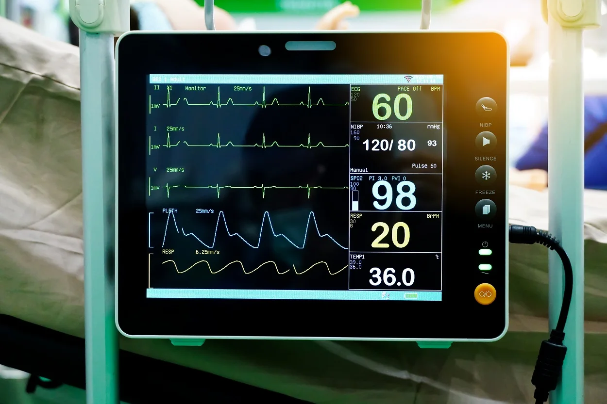 What Happens During an ECG or EKG Test?