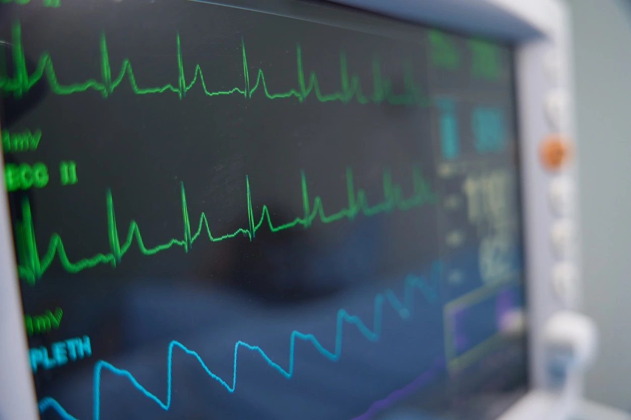 Why Do I Need a Heart Rhythm Monitor?