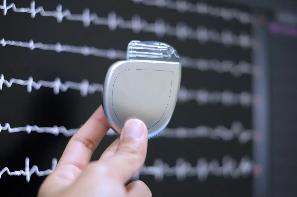 Implantable Cardioverter Defibrillator (ICD)